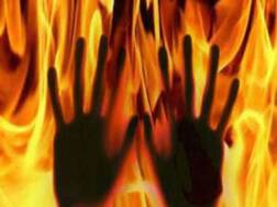 यूपी में फिर उन्नाव जैसा कांड, रेप के बाद पीड़िता को जलाया जिंदा, इलाज के दौरान अस्पताल में हुई मौत