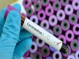 उन्नाव में मिले Coronovirus के संदिग्ध मरीज, जांच के लिए लखनऊ भेजा गया ब्लड सैंपल two suspected patients of corona virus found in unnao उन्नाव में मिले Coronovirus के संदिग्ध मरीज, जांच के लिए लखनऊ भेजा गया ब्लड सैंपल