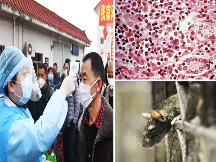Coronavirus के बीच चीन में खतरनाक 'हंता' वायरस की दस्तक, जानिए-इसके लक्षण और बचाव के उपाय After Coronavirus pandemic hantavirus spread in china one died