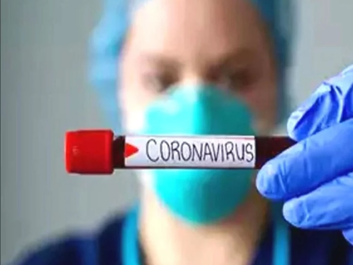 Coronavirus ने ली इस मशहूर सिंगर की जान, दुनिया के तमाम कलाकारों ने जताया दुख