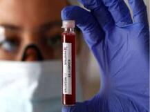 Coronavirus in UP: उन्नाव में पहला कोरोना पॉजिटिव मरीज मिलने से मचा हड़कंप, तब्लीगी जमात में शामिल होने की चर्चा