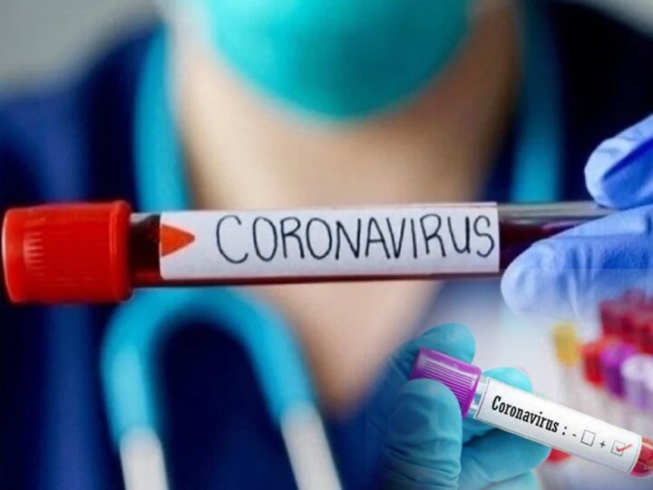 Coronavirus patients number in Prayagraj increased 100  graph of recovered people increased प्रयागराज में संक्रमित मरीजों का आंकड़ा हुआ 100, स्वस्थ होने वालों का ग्राफ बढ़ा