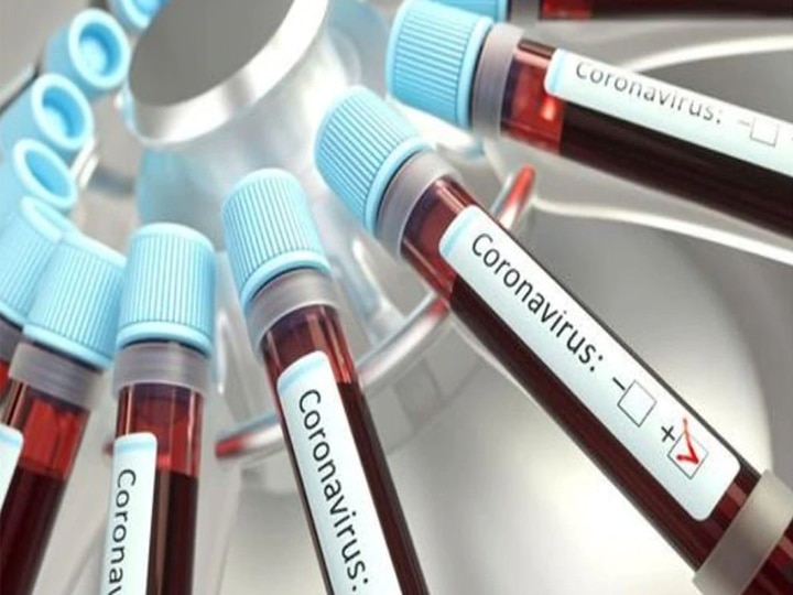 Coronavirus 14 new cases found in lucknow including four nurses लखनऊ में 14 नए केस, 4 नर्स कोरोना संक्रमित निकलने के बाद फातिमा हॉस्पिटल बंद