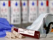 उत्तराखंड में कोरोना संक्रमितों की संख्या 1500 के पार, अबतक 15 मरीजों की जा चुकी है जान