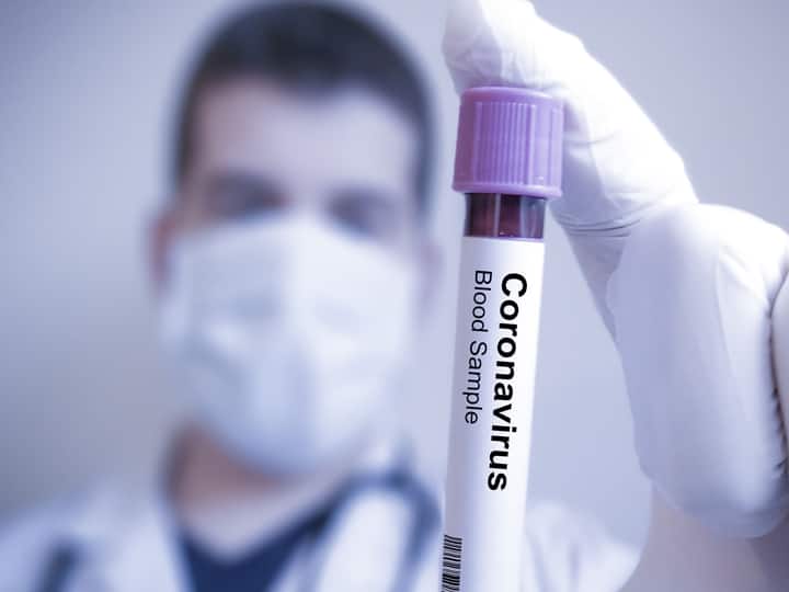 Uttarakhand coronavirus updates covid cases reached 1836 उत्तराखंड में 1836 हुआ कोरोना संक्रमितों का आंकड़ा, सोमवार को 17 नए केस ने बढ़ाई चिंता